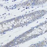 H4K20me1 Antibody in Immunohistochemistry (Paraffin) (IHC (P))