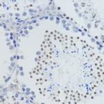 H4K20me1 Antibody in Immunohistochemistry (Paraffin) (IHC (P))