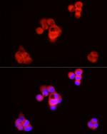 SQLE Antibody in Immunocytochemistry (ICC/IF)