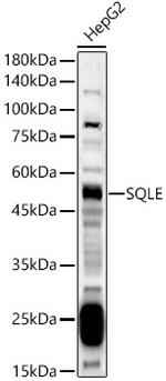 SQLE Antibody in Western Blot (WB)