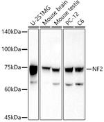 NF2 Antibody in Western Blot (WB)