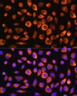 HSC70 Antibody in Immunocytochemistry (ICC/IF)