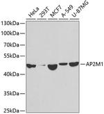 AP2M1 Antibody in Western Blot (WB)