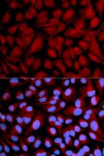 CASK Antibody in Immunocytochemistry (ICC/IF)