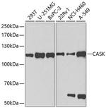 CASK Antibody in Western Blot (WB)