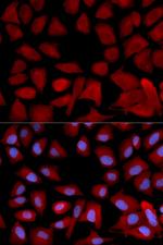 PSMC4 Antibody in Immunocytochemistry (ICC/IF)