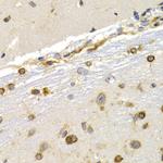 EEF1D Antibody in Immunohistochemistry (Paraffin) (IHC (P))