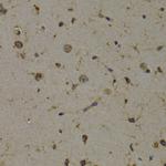 EEF1D Antibody in Immunohistochemistry (Paraffin) (IHC (P))