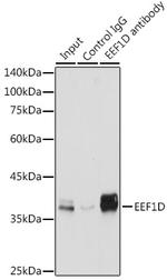 EEF1D Antibody in Immunoprecipitation (IP)