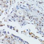 PLK1 Antibody in Immunohistochemistry (Paraffin) (IHC (P))