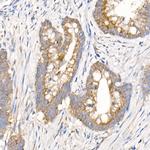 MMP14 Antibody in Immunohistochemistry (Paraffin) (IHC (P))