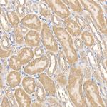 MMP14 Antibody in Immunohistochemistry (Paraffin) (IHC (P))