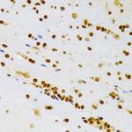 HMGB1 Antibody in Immunohistochemistry (Paraffin) (IHC (P))