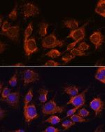 AIF Antibody in Immunocytochemistry (ICC/IF)