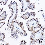 PDCD4 Antibody in Immunohistochemistry (Paraffin) (IHC (P))