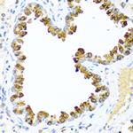 NRG4 Antibody in Immunohistochemistry (Paraffin) (IHC (P))