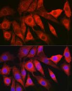 LAMTOR5 Antibody in Immunocytochemistry (ICC/IF)