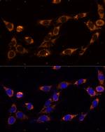 TRAP1 Antibody in Immunocytochemistry (ICC/IF)