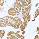 TRAP1 Antibody in Immunohistochemistry (Paraffin) (IHC (P))