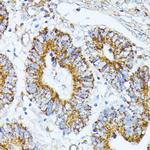 TRAP1 Antibody in Immunohistochemistry (Paraffin) (IHC (P))