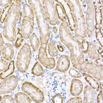 Protein APC Antibody in Immunohistochemistry (Paraffin) (IHC (P))