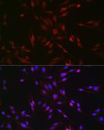 EDA Antibody in Immunocytochemistry (ICC/IF)