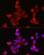 EDA Antibody in Immunocytochemistry (ICC/IF)