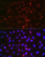 EDA Antibody in Immunocytochemistry (ICC/IF)