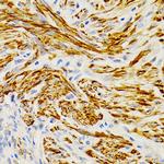 EDA Antibody in Immunohistochemistry (Paraffin) (IHC (P))