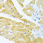 EDA Antibody in Immunohistochemistry (Paraffin) (IHC (P))