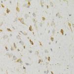 KISS1R Antibody in Immunohistochemistry (Paraffin) (IHC (P))