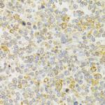 KISS1R Antibody in Immunohistochemistry (Paraffin) (IHC (P))