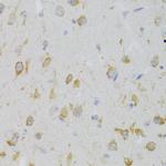 KISS1R Antibody in Immunohistochemistry (Paraffin) (IHC (P))