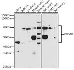 KISS1R Antibody in Western Blot (WB)