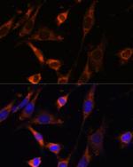 CKMT1B Antibody in Immunocytochemistry (ICC/IF)