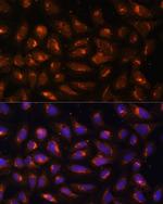 CKMT1B Antibody in Immunocytochemistry (ICC/IF)