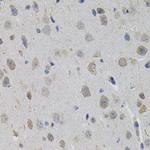 SUMO-3 Antibody in Immunohistochemistry (Paraffin) (IHC (P))