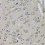 SUMO-3 Antibody in Immunohistochemistry (Paraffin) (IHC (P))