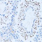 NFkB p100 Antibody in Immunohistochemistry (Paraffin) (IHC (P))