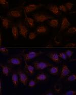 PP2A beta Antibody in Immunocytochemistry (ICC/IF)