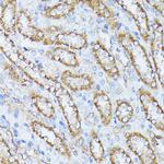 PP2A beta Antibody in Immunohistochemistry (Paraffin) (IHC (P))