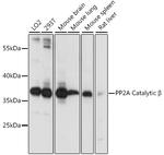 PP2A beta Antibody in Western Blot (WB)