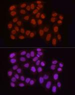 H3R2me2a Antibody in Immunocytochemistry (ICC/IF)