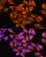 AMPD1 Antibody in Immunocytochemistry (ICC/IF)