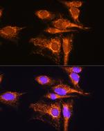 AMPD1 Antibody in Immunocytochemistry (ICC/IF)