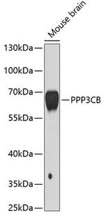 PPP3CB Antibody in Western Blot (WB)