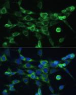 COX6A1 Antibody in Immunocytochemistry (ICC/IF)