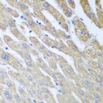 FUT6 Antibody in Immunohistochemistry (Paraffin) (IHC (P))