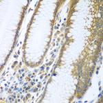 FUT6 Antibody in Immunohistochemistry (Paraffin) (IHC (P))