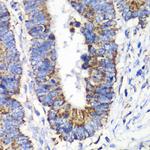 RALB Antibody in Immunohistochemistry (Paraffin) (IHC (P))